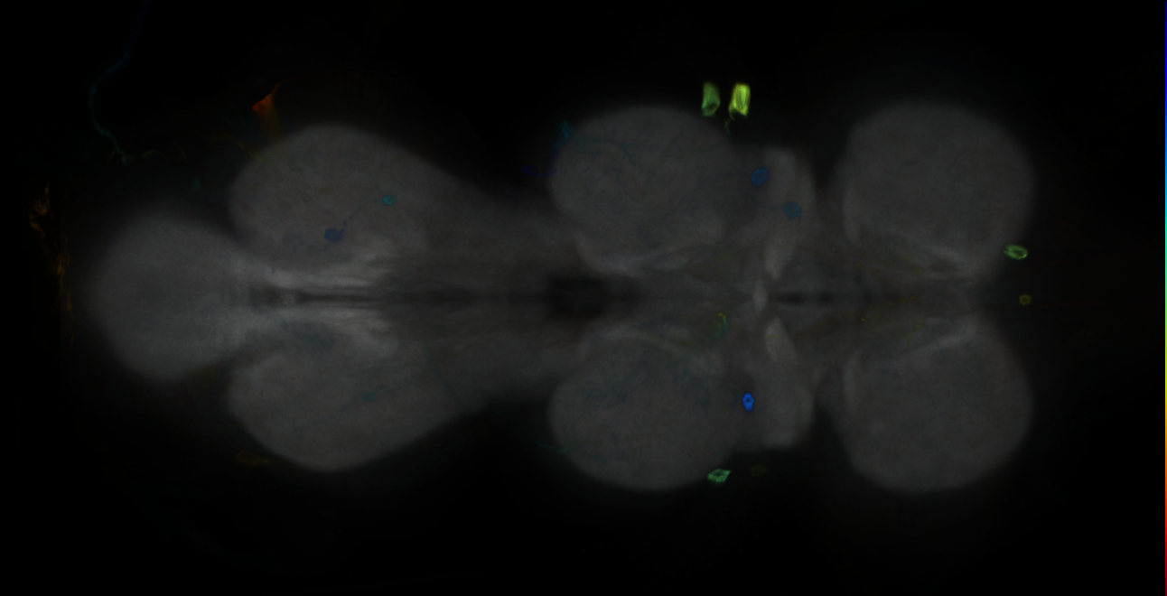 P{GMR11B11-GAL4} expression pattern