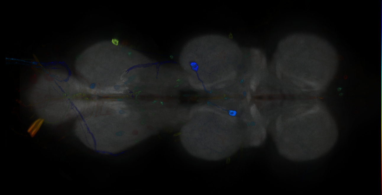 P{GMR11C07-GAL4} expression pattern
