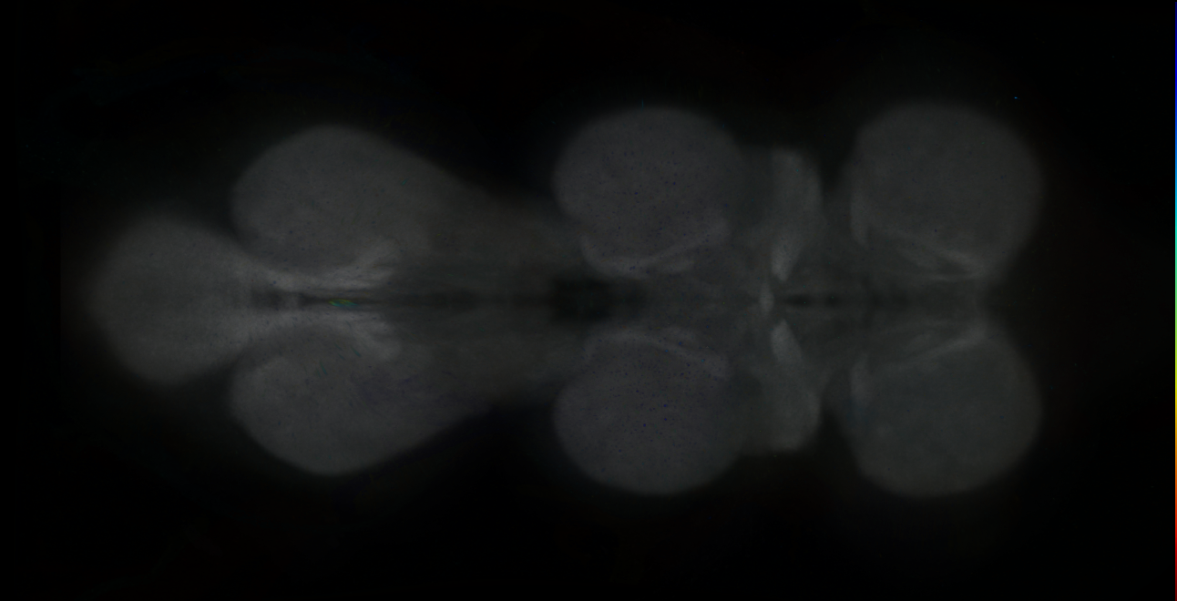 P{GMR11D10-GAL4} expression pattern