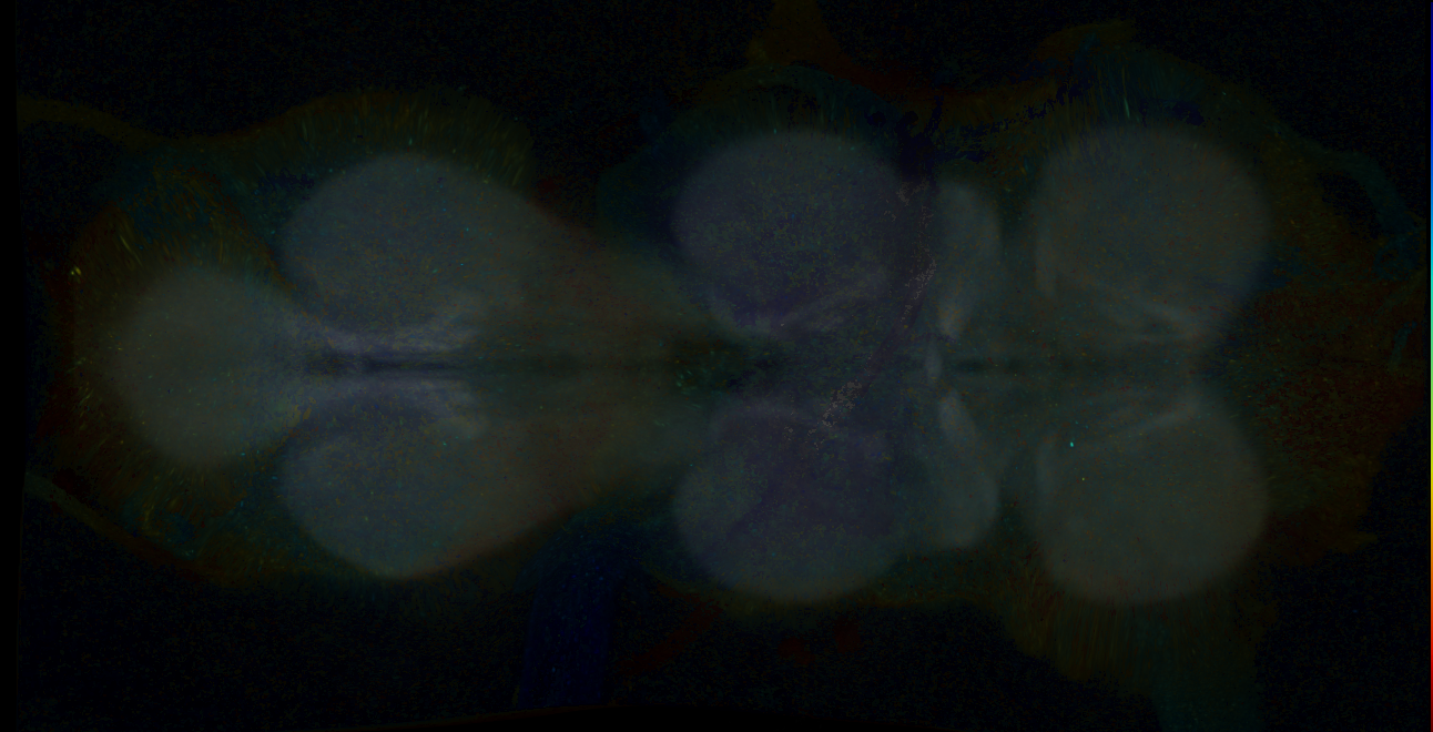 P{GMR11E02-GAL4} expression pattern