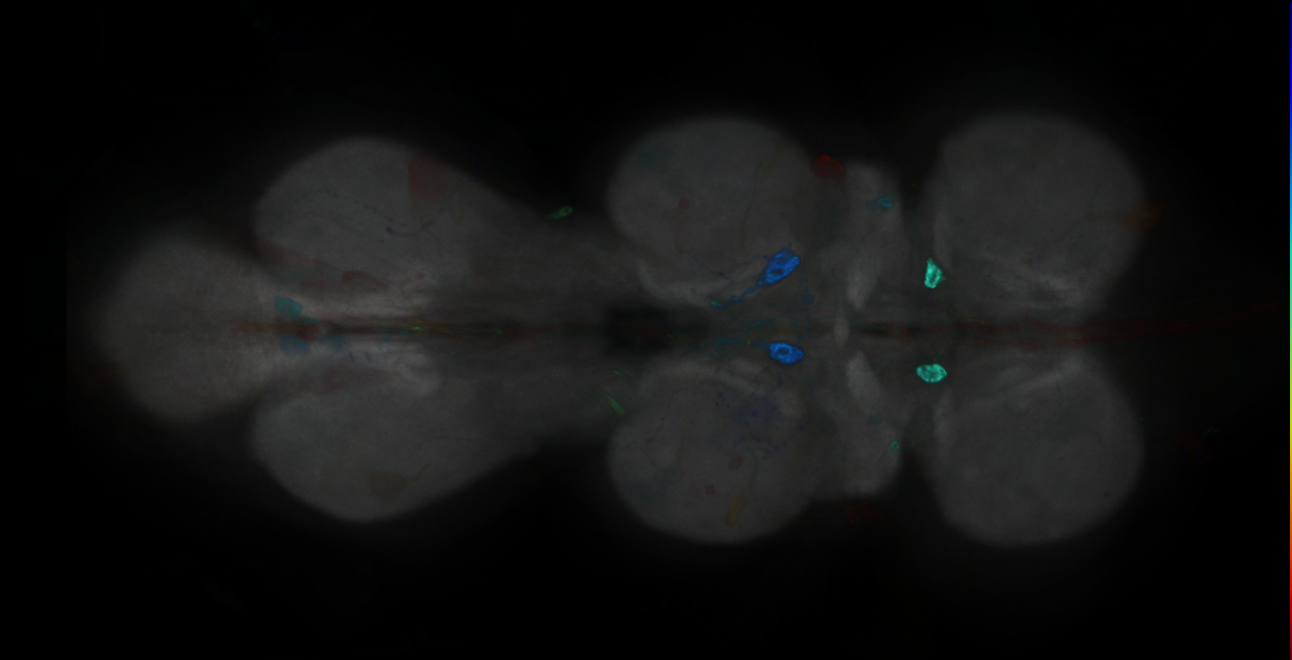 P{GMR11G08-GAL4} expression pattern