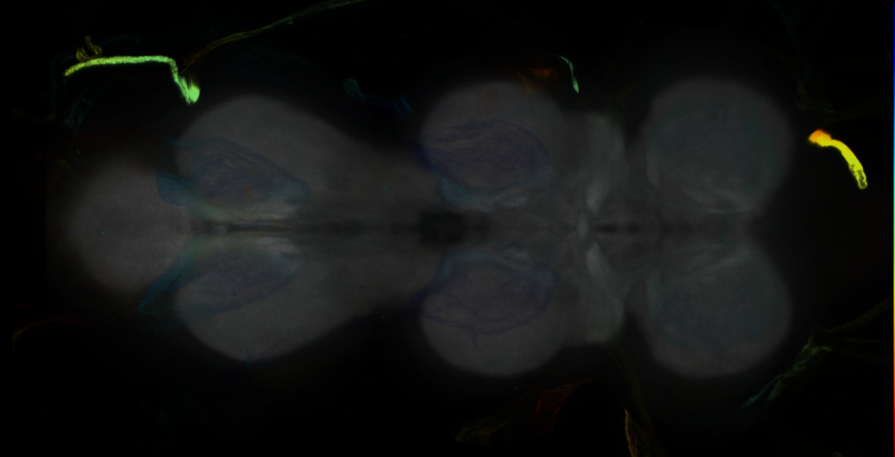 P{GMR11H01-GAL4} expression pattern