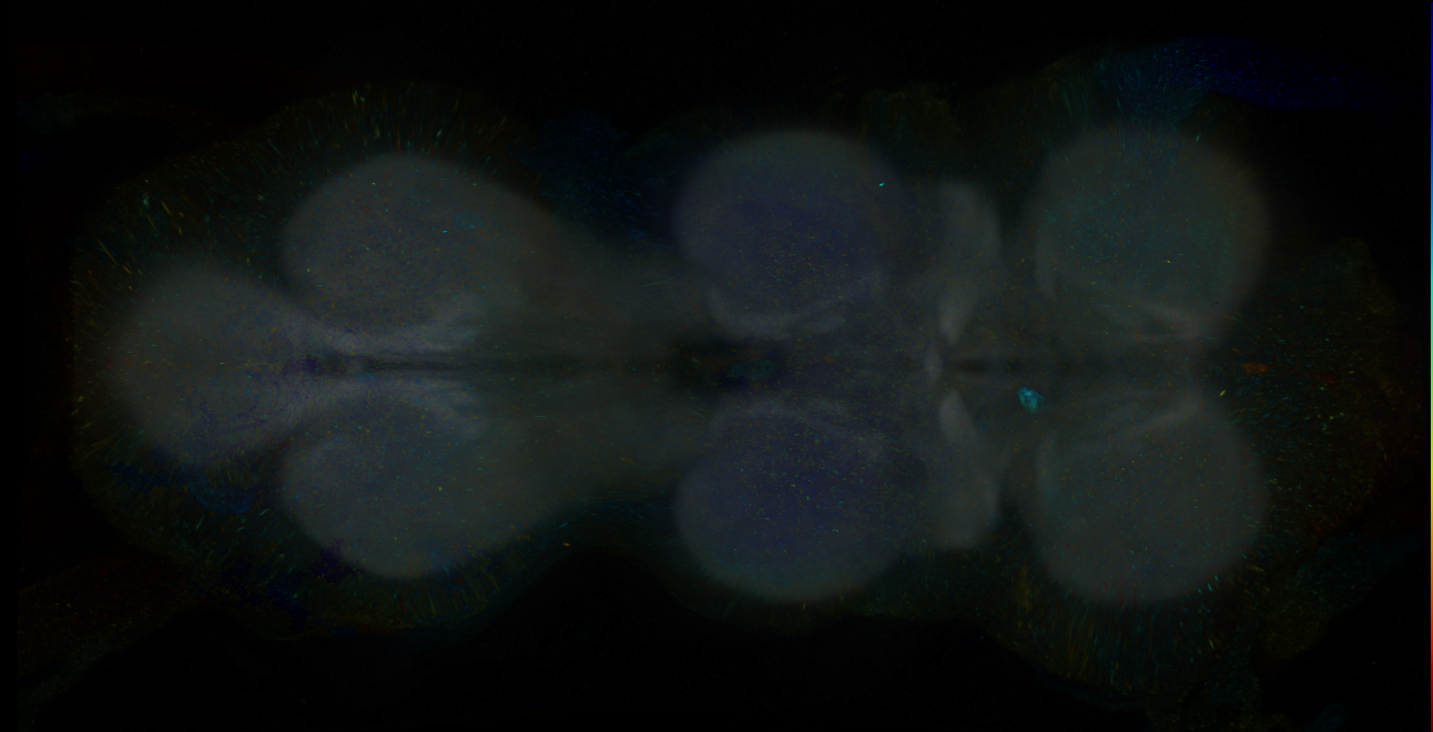 P{GMR11H06-GAL4} expression pattern