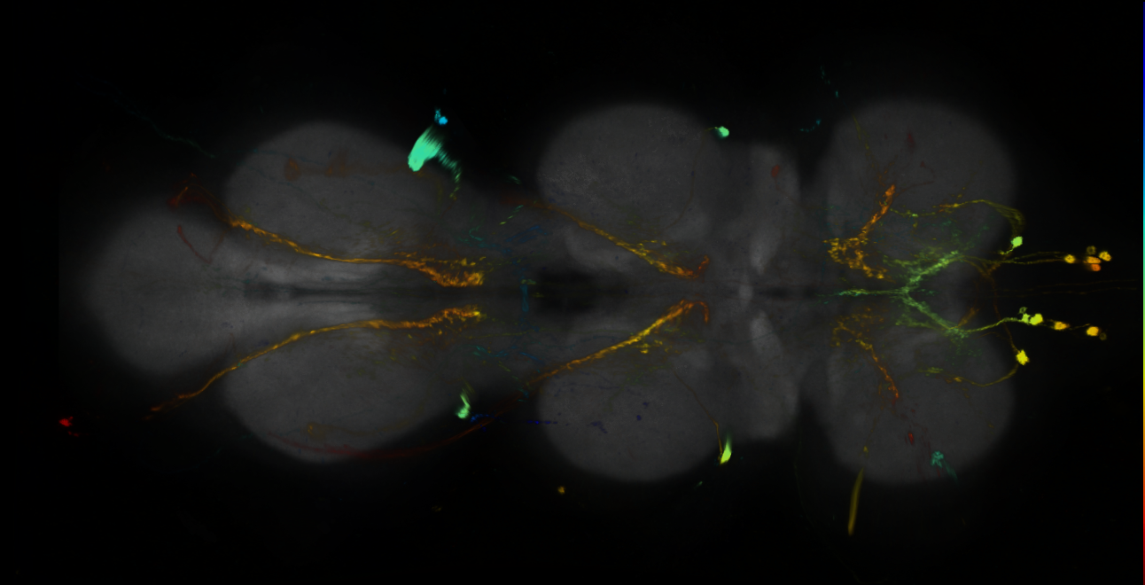P{GMR11H10-GAL4} expression pattern