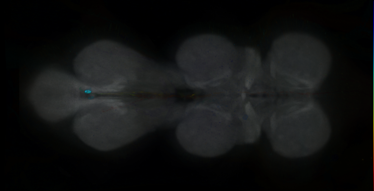 P{GMR12A01-GAL4} expression pattern