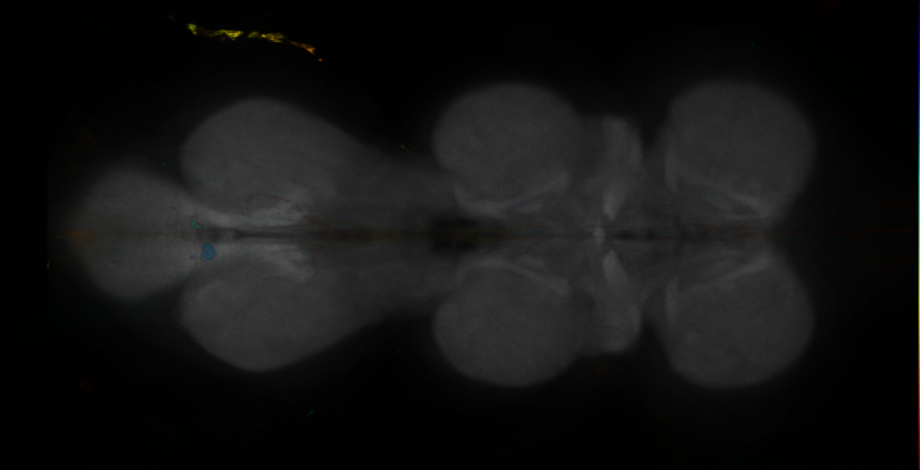 P{GMR12A06-GAL4} expression pattern