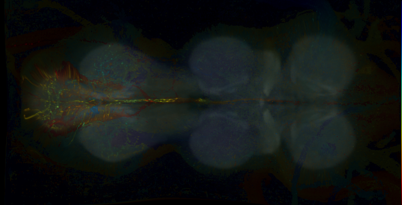 P{GMR12A10-GAL4} expression pattern
