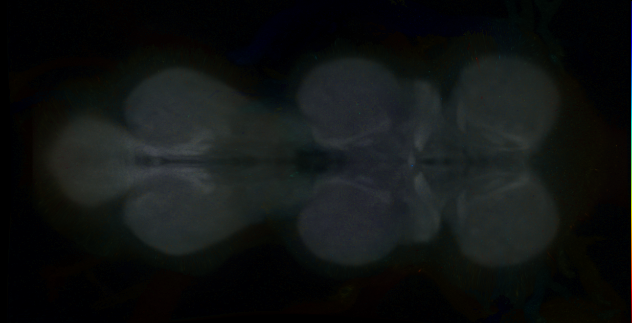 P{GMR12B07-GAL4} expression pattern