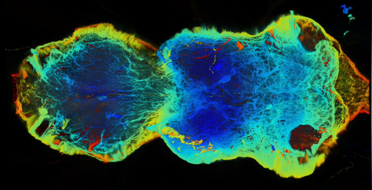 P{GMR12E12-GAL4} expression pattern
