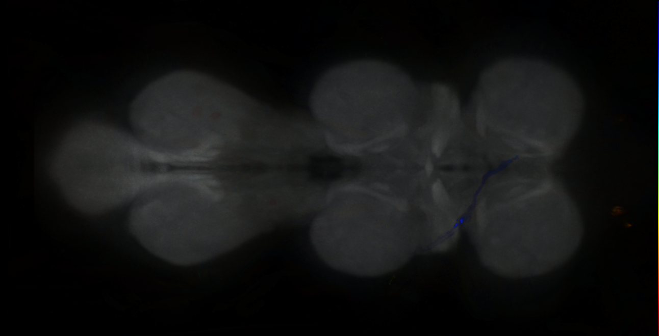 P{GMR12G08-GAL4} expression pattern