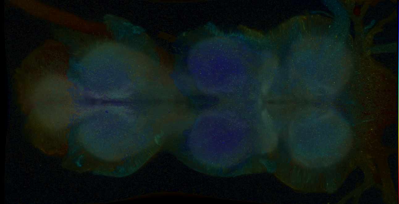 P{GMR12H06-GAL4} expression pattern
