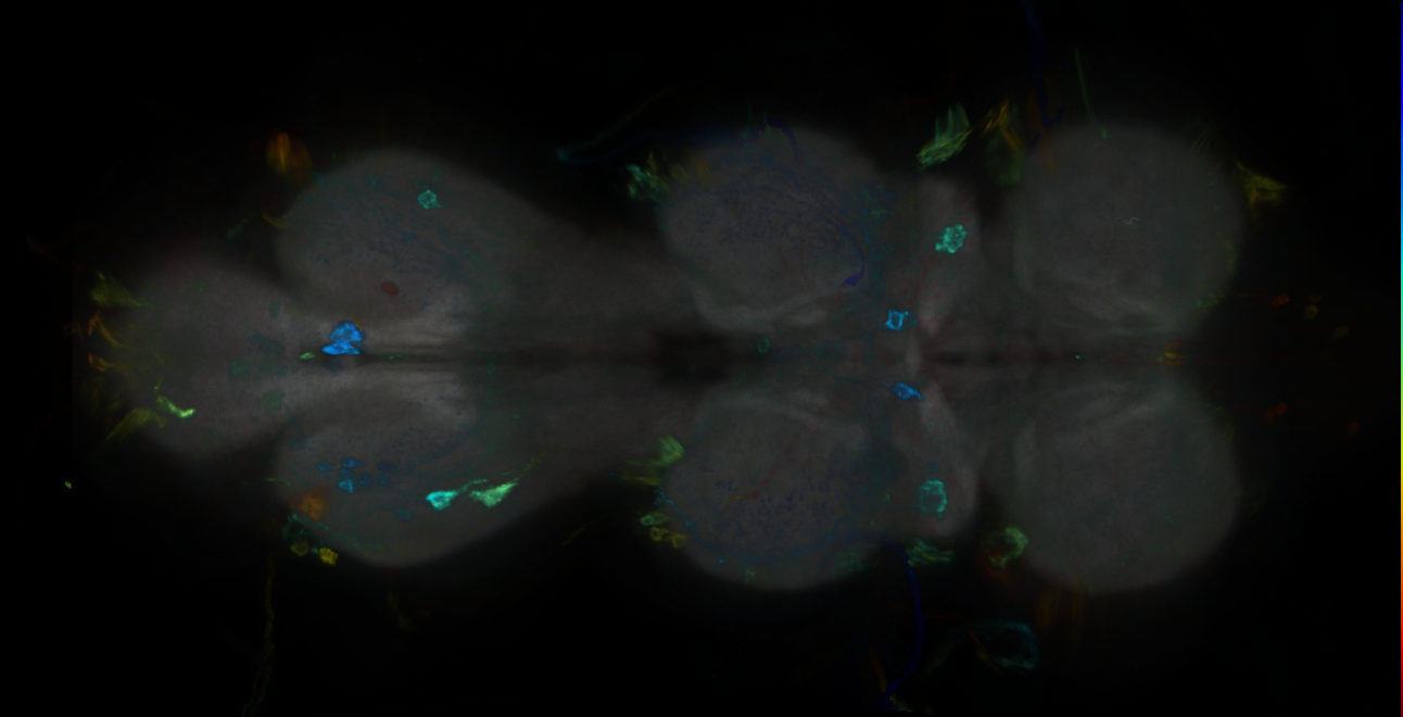 P{GMR13A08-GAL4} expression pattern