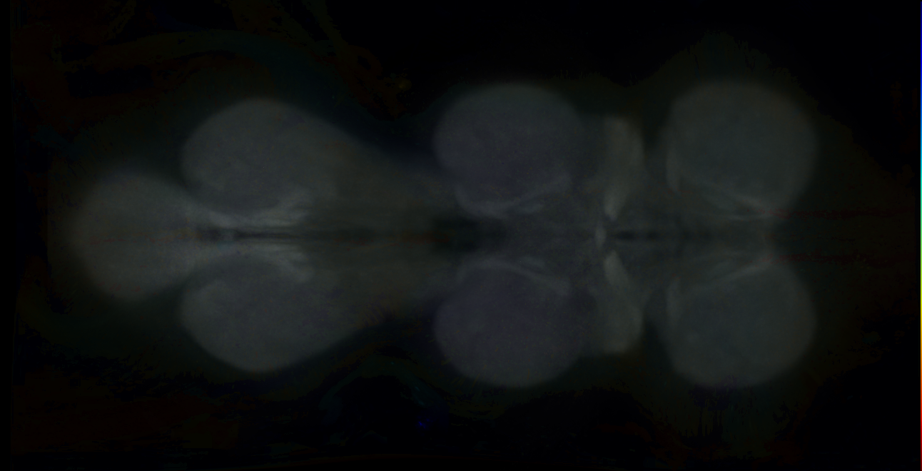 P{GMR13B04-GAL4} expression pattern