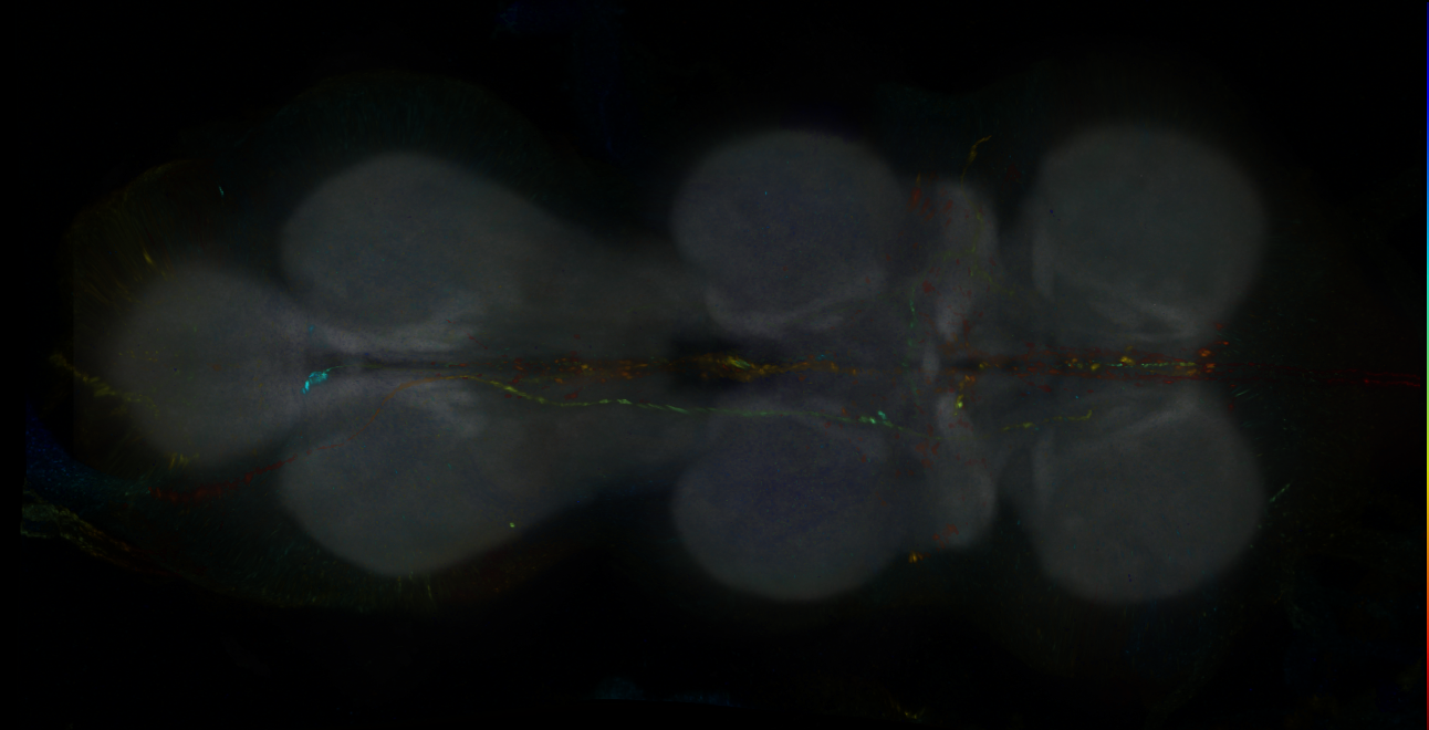 P{GMR13D04-GAL4} expression pattern