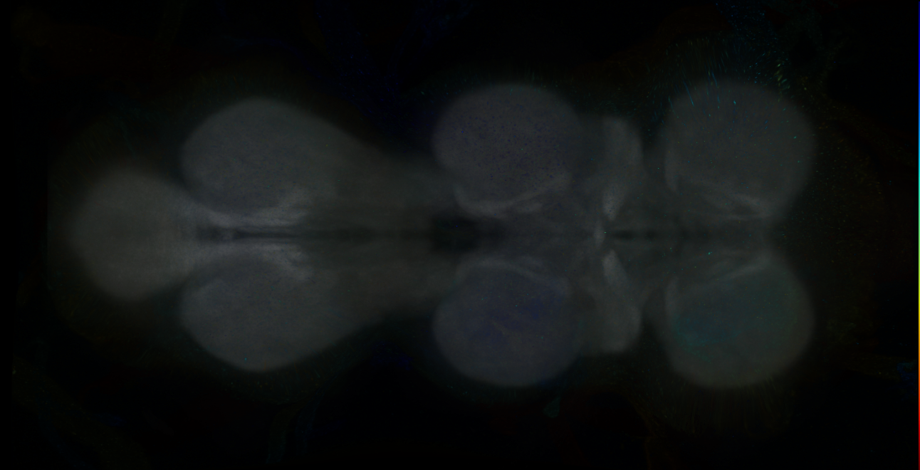 P{GMR13H06-GAL4} expression pattern