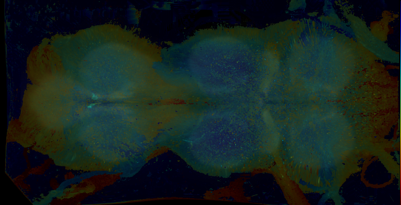 P{GMR13H07-GAL4} expression pattern