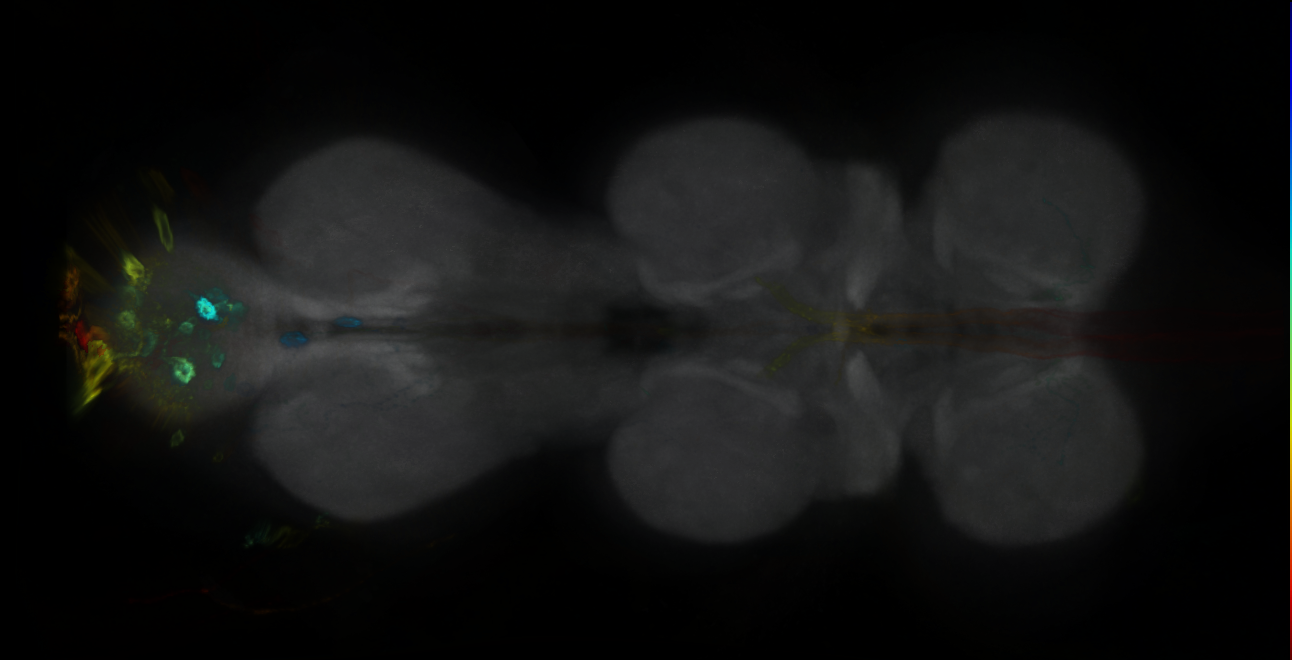 P{GMR14A01-GAL4} expression pattern