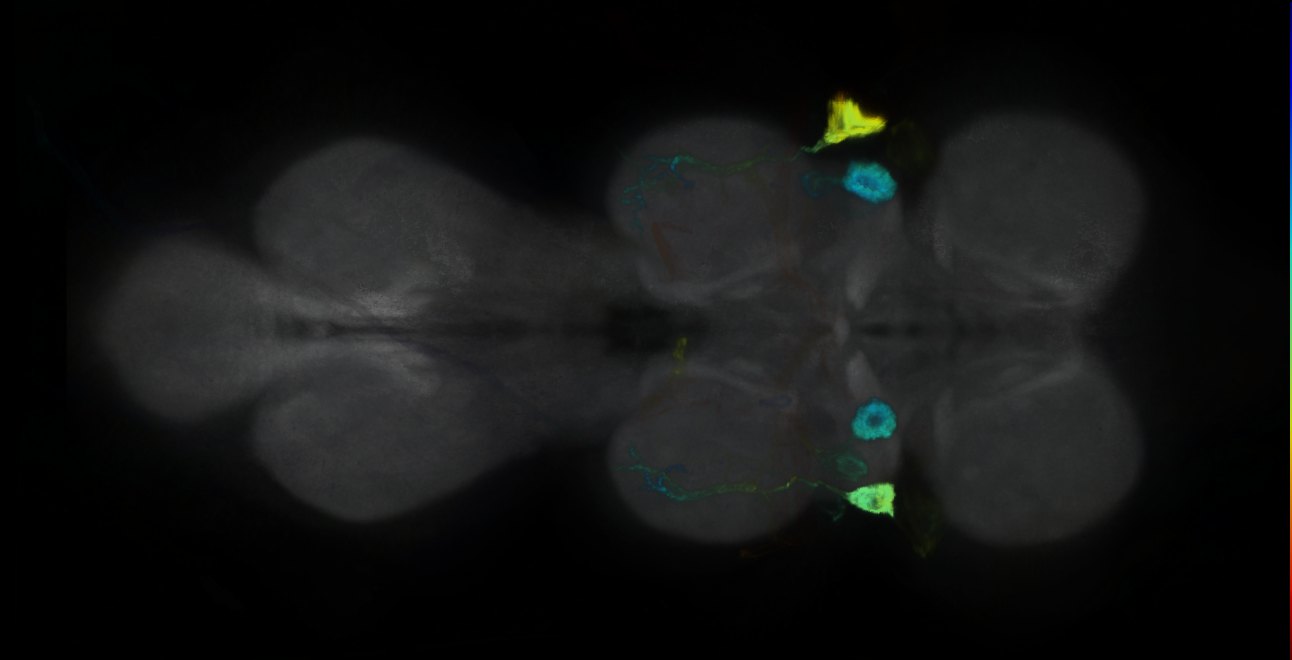 P{GMR14A02-GAL4} expression pattern