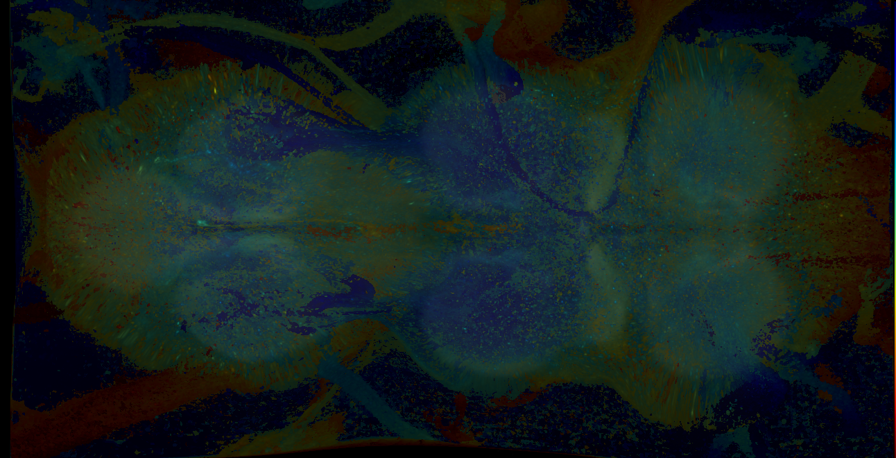 P{GMR14A03-GAL4} expression pattern