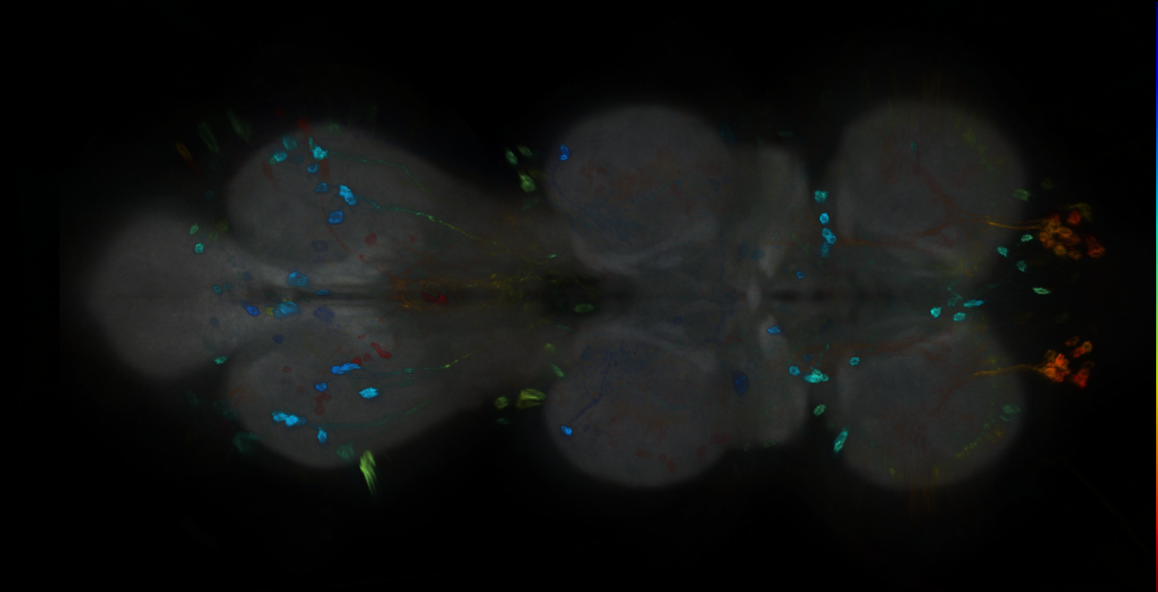 P{GMR14A07-GAL4} expression pattern