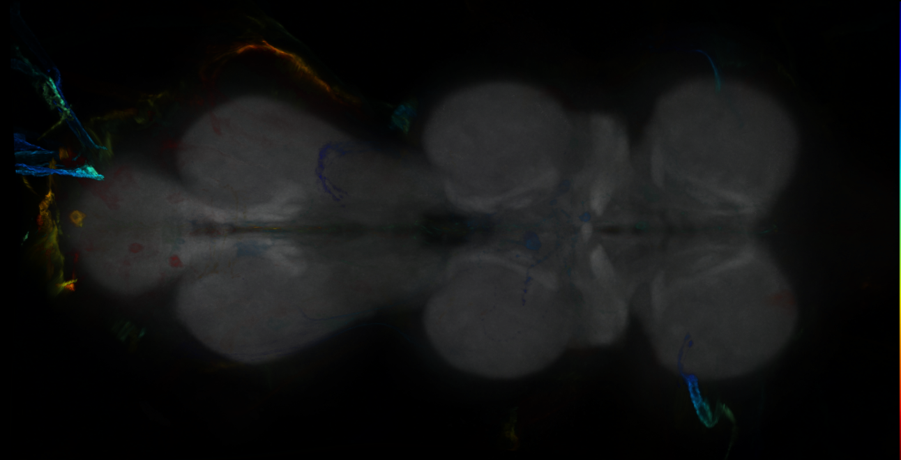 P{GMR14A08-GAL4} expression pattern
