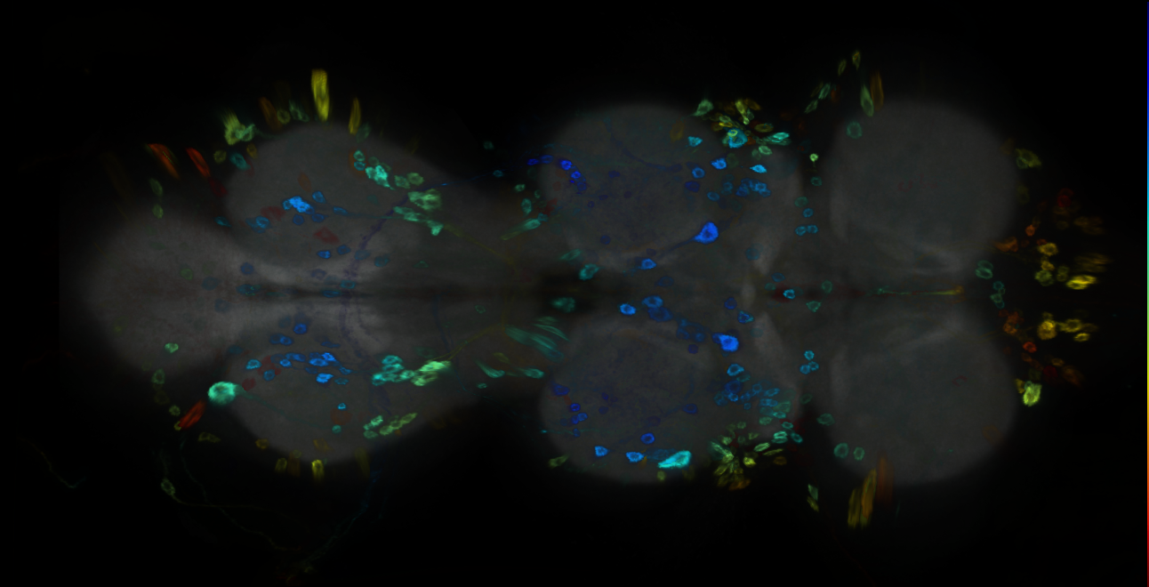P{GMR14B01-GAL4} expression pattern