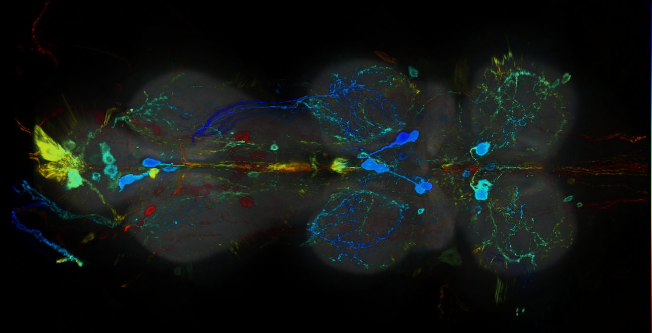 P{GMR14B03-GAL4} expression pattern