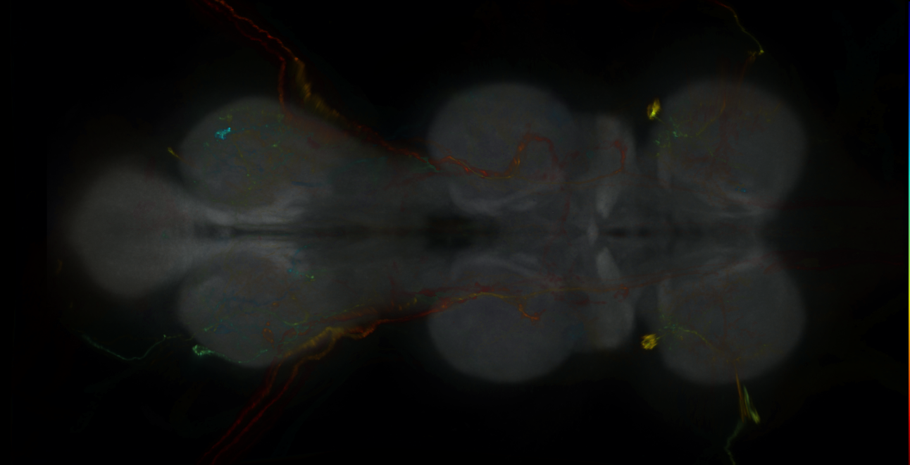 P{GMR14B04-GAL4} expression pattern