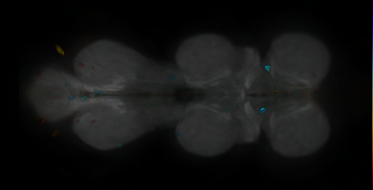 P{GMR14B07-GAL4} expression pattern