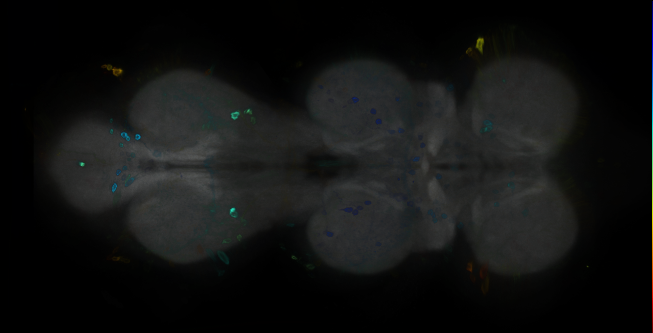 P{GMR14B11-GAL4} expression pattern