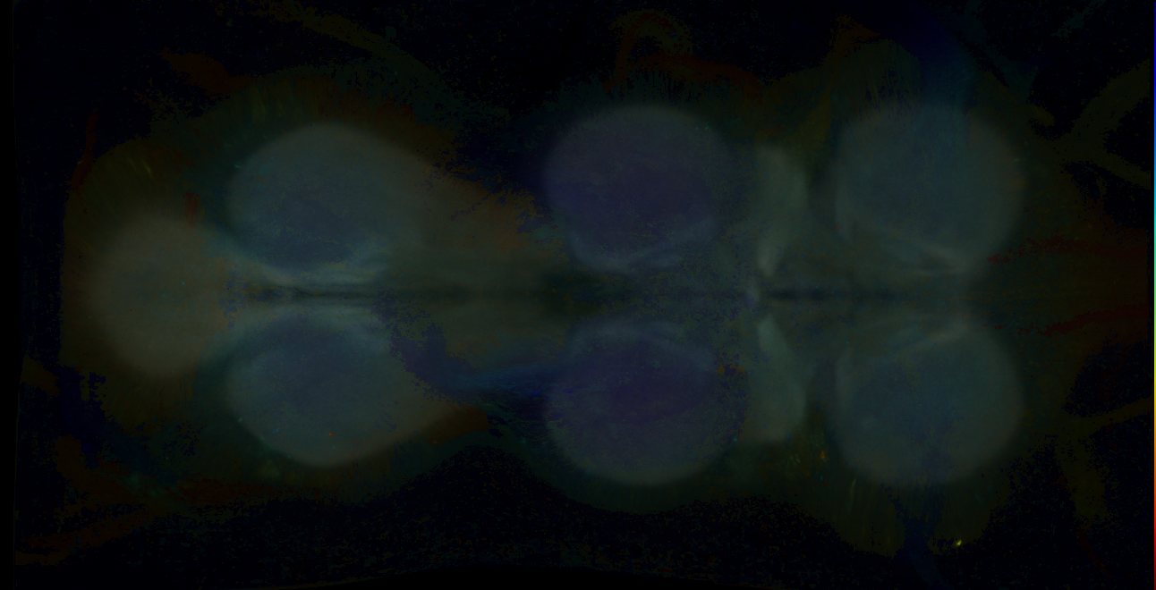 P{GMR14C01-GAL4} expression pattern