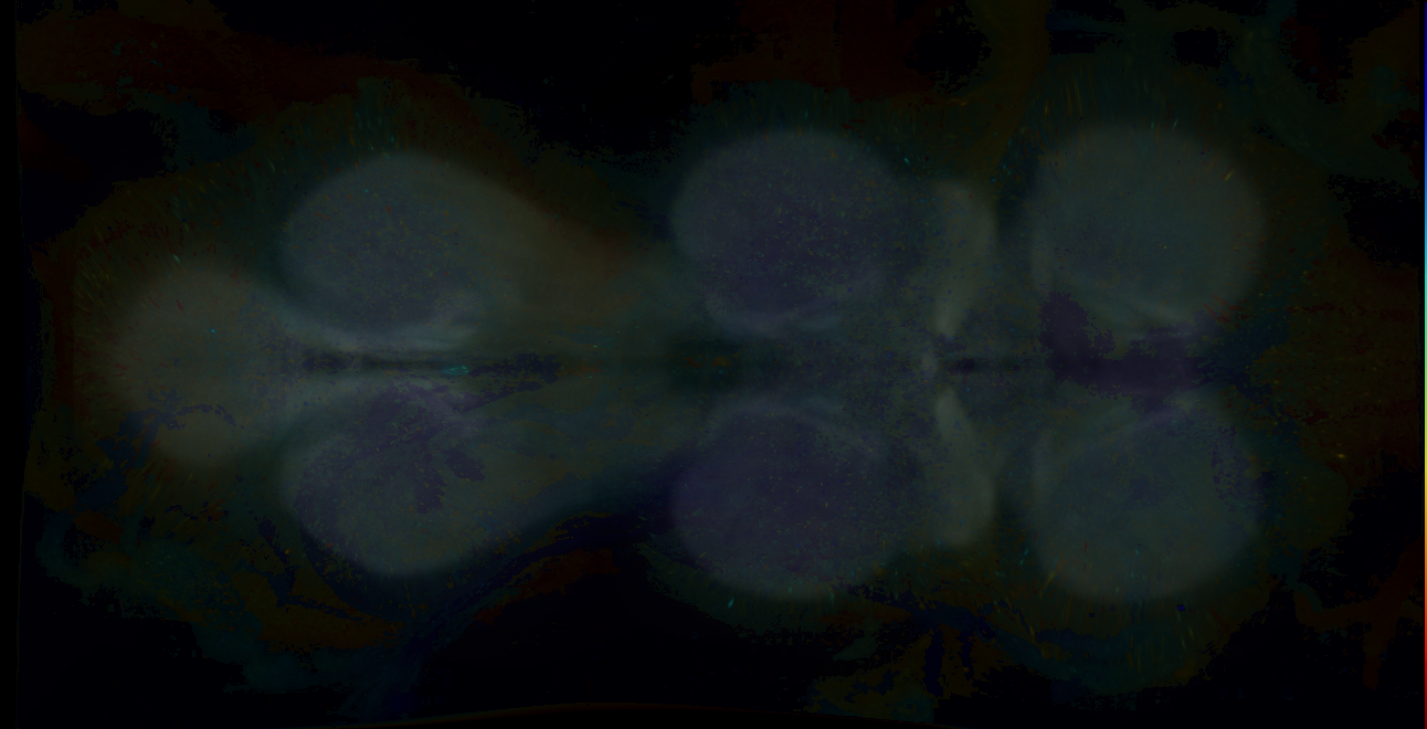 P{GMR14C02-GAL4} expression pattern
