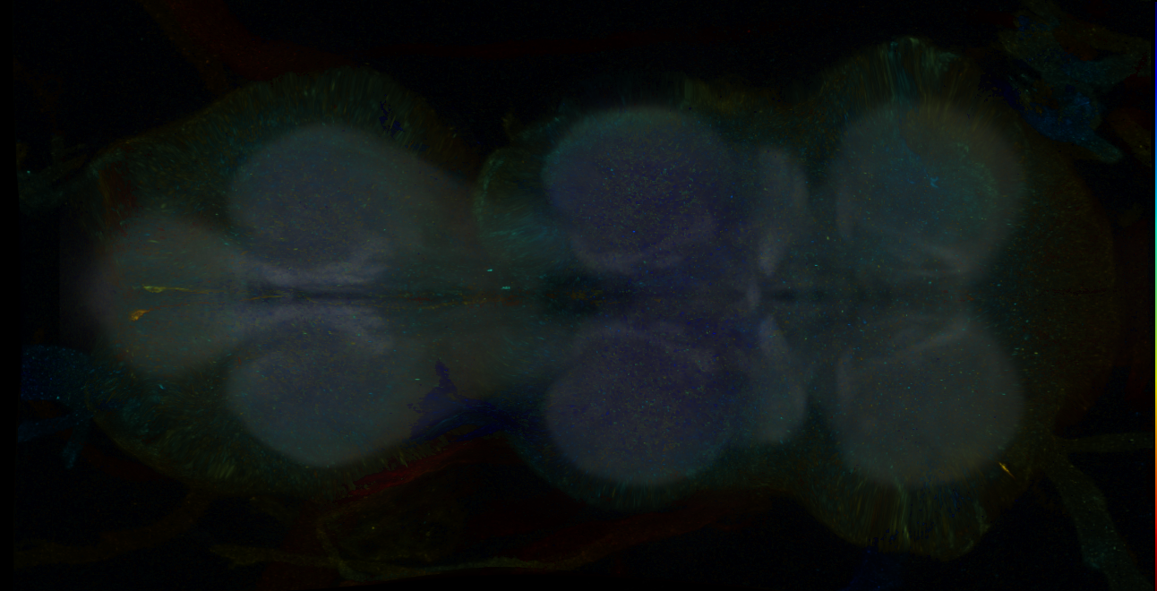 P{GMR14C11-GAL4} expression pattern