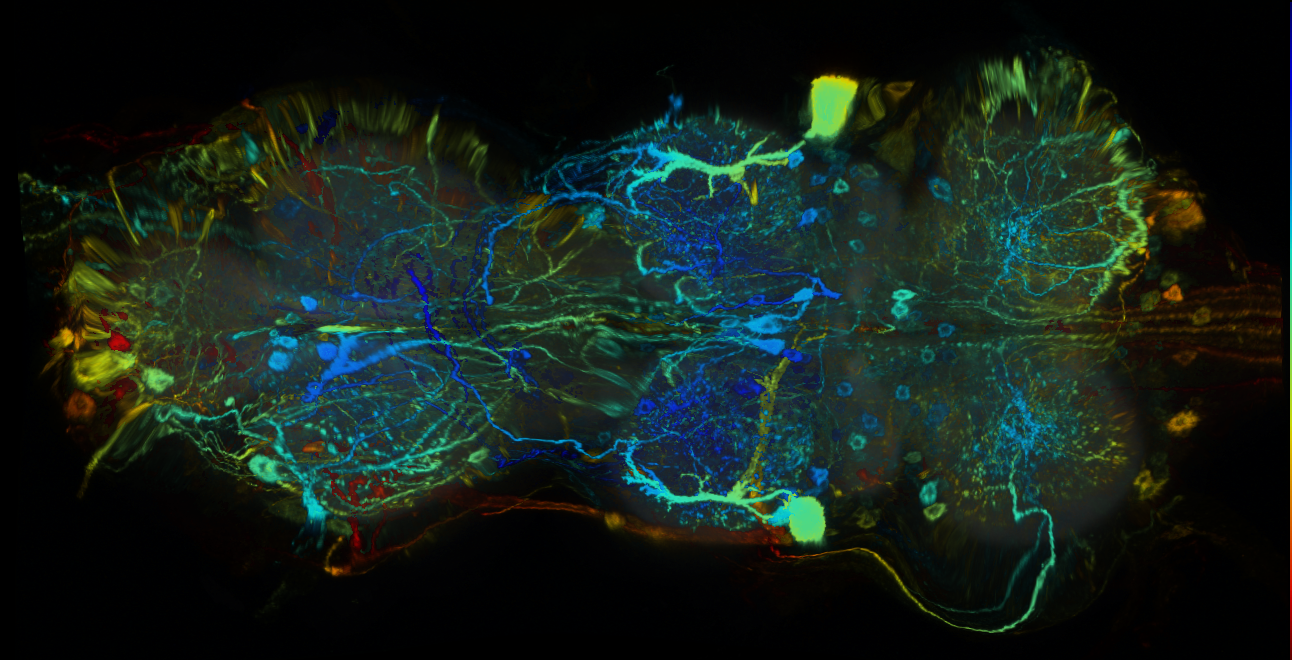 P{GMR14D03-GAL4} expression pattern