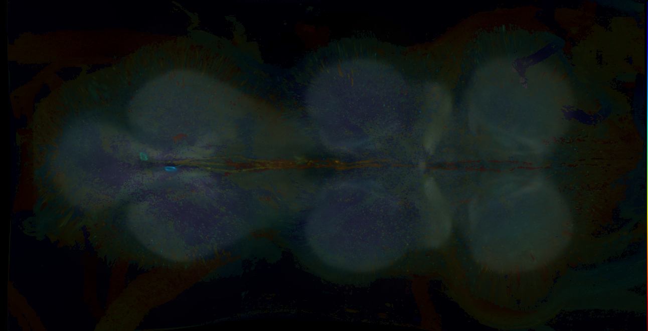 P{GMR14D04-GAL4} expression pattern