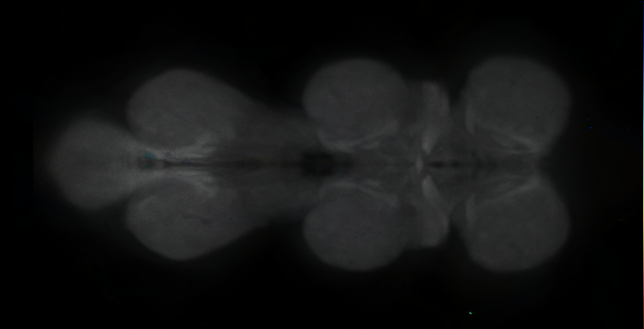 P{GMR14D05-GAL4} expression pattern
