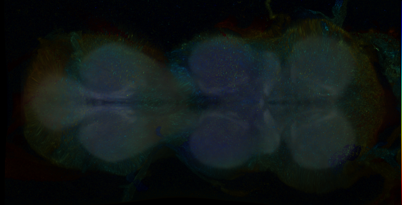 P{GMR14D09-GAL4} expression pattern