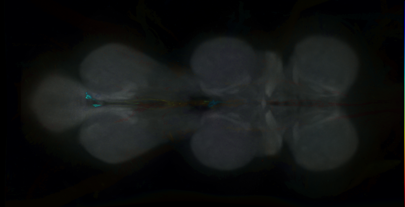 P{GMR14D10-GAL4} expression pattern