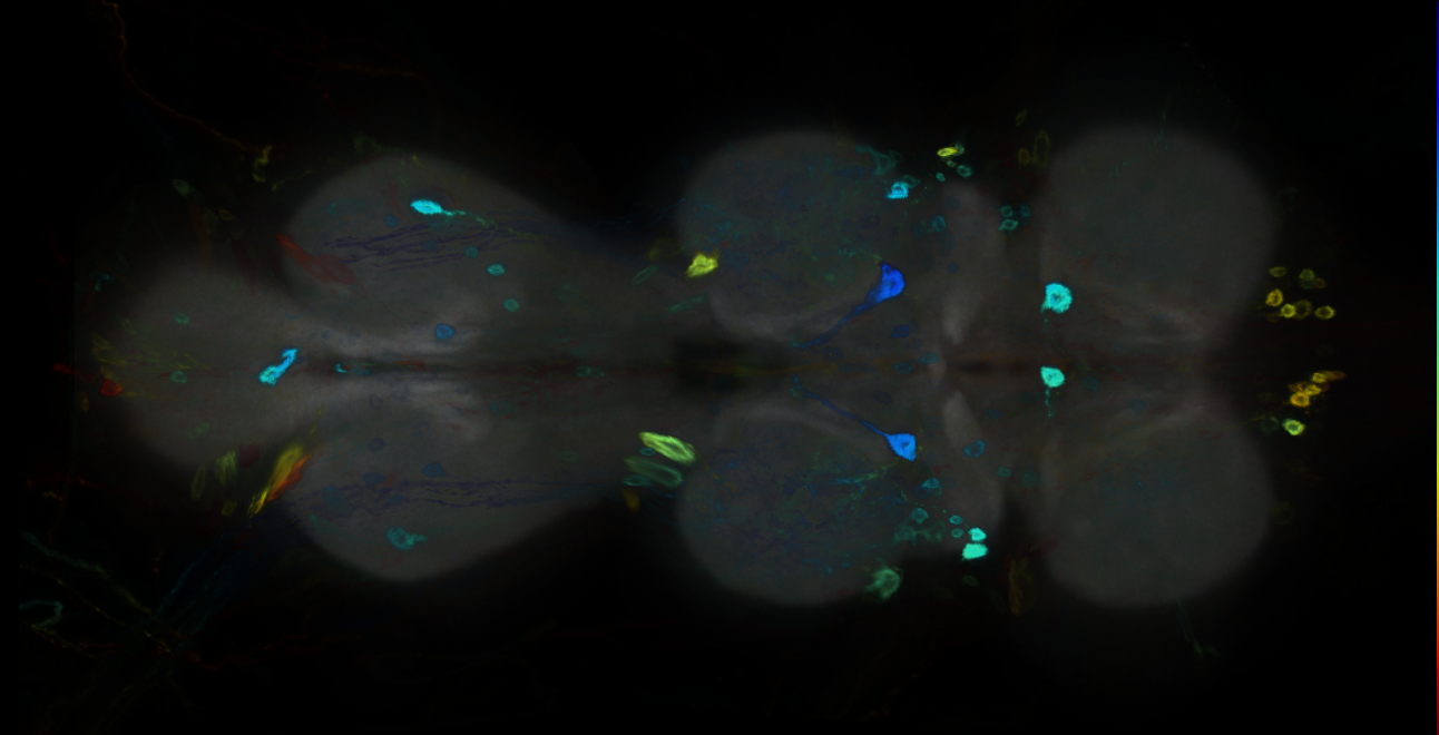 P{GMR14E04-GAL4} expression pattern