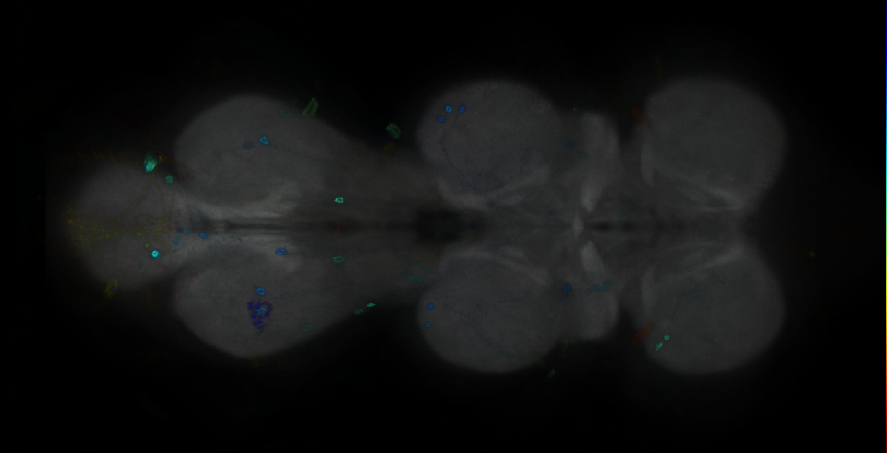 P{GMR14E05-GAL4} expression pattern