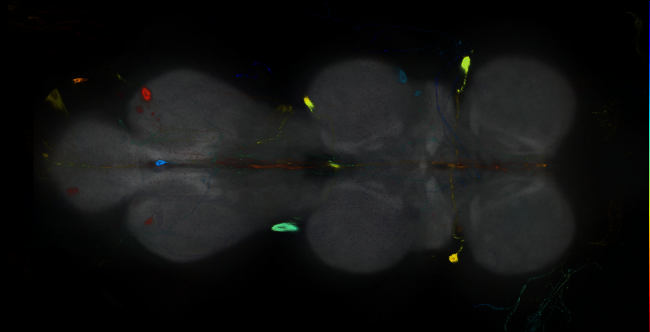P{GMR14E11-GAL4} expression pattern