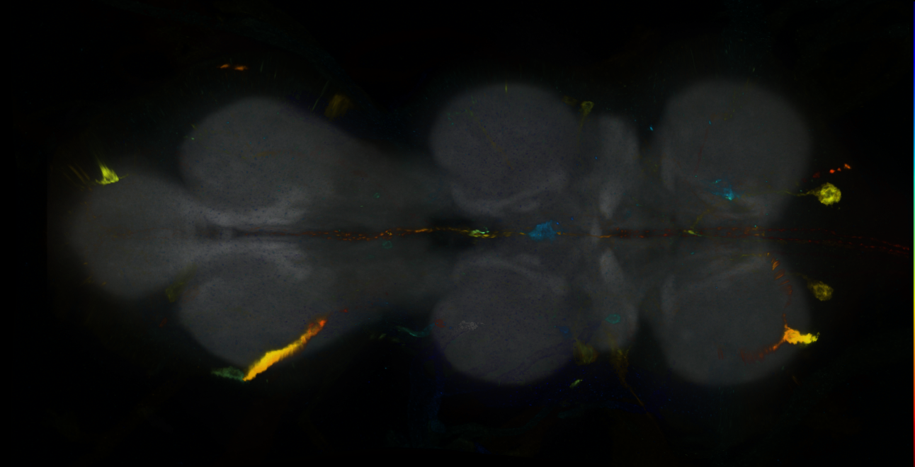 P{GMR14F03-GAL4} expression pattern