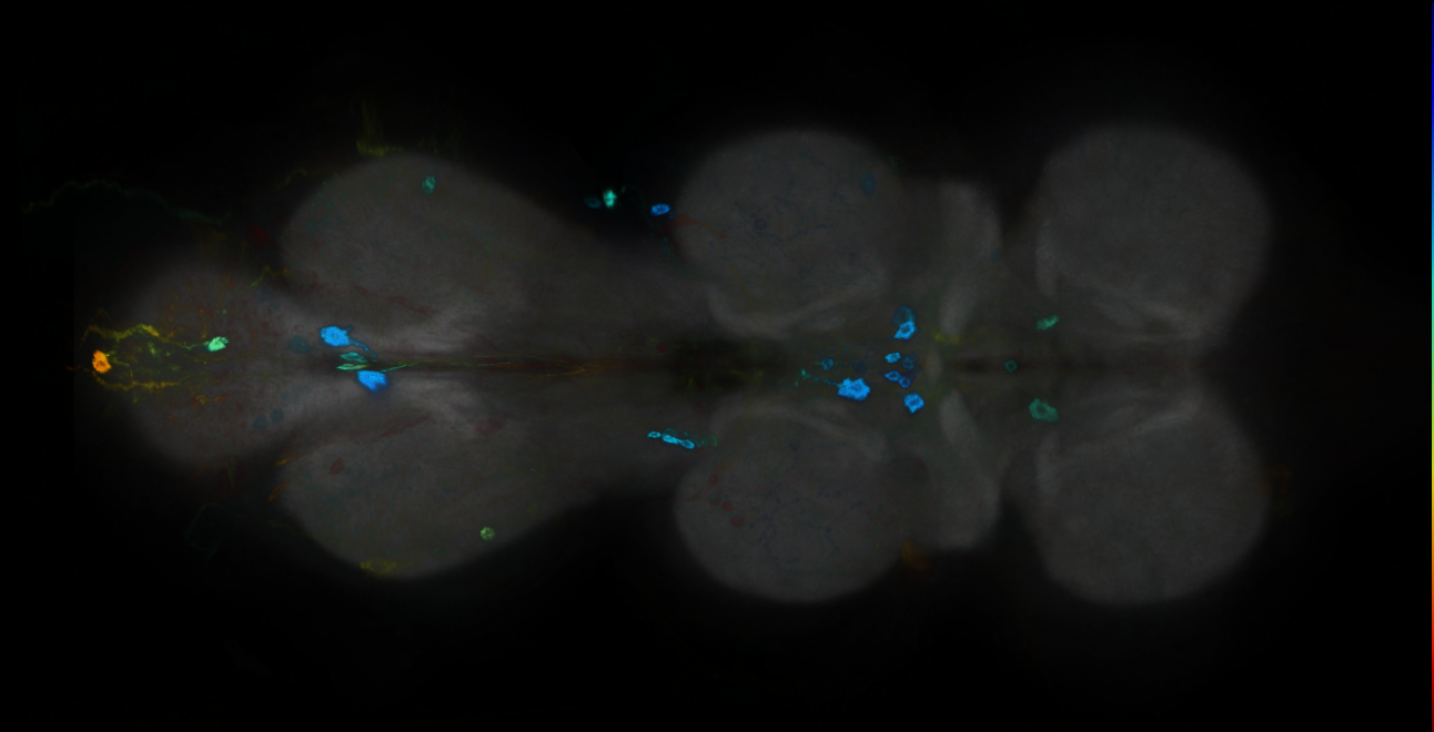 P{GMR14F06-GAL4} expression pattern