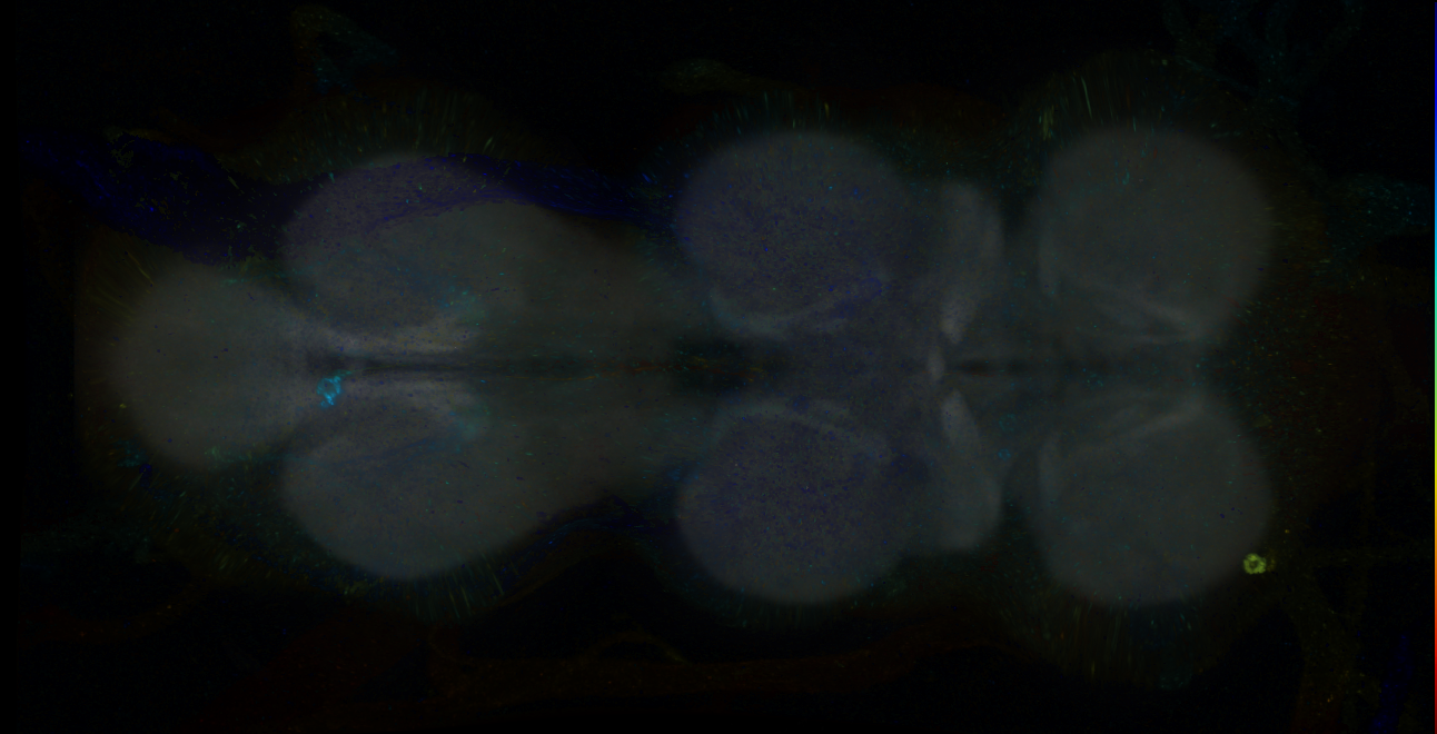 P{GMR14F07-GAL4} expression pattern