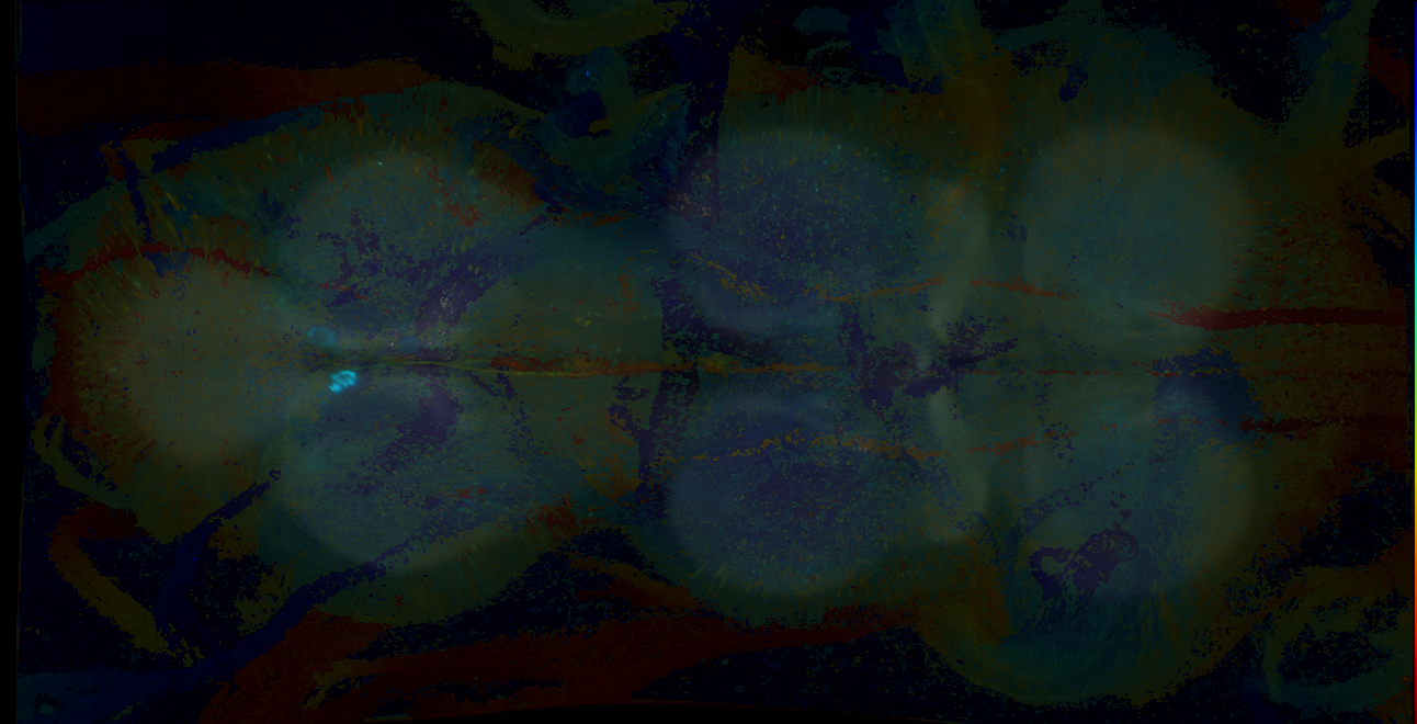 P{GMR14F10-GAL4} expression pattern