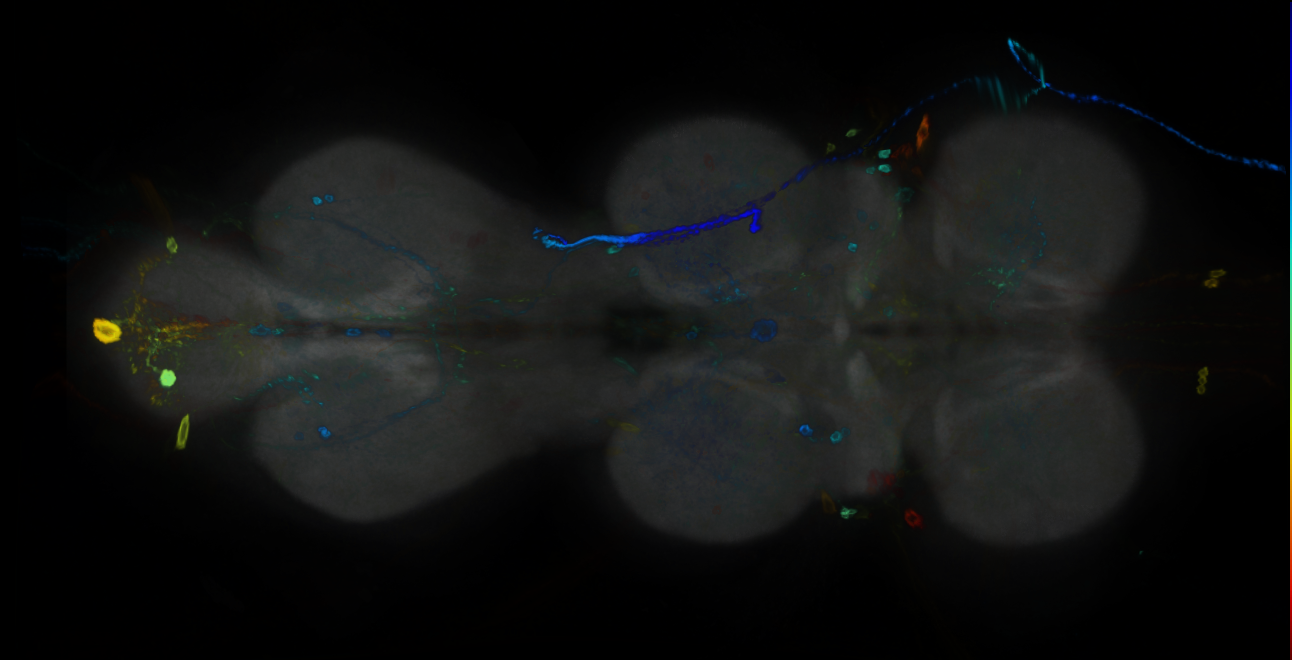 P{GMR14F11-GAL4} expression pattern