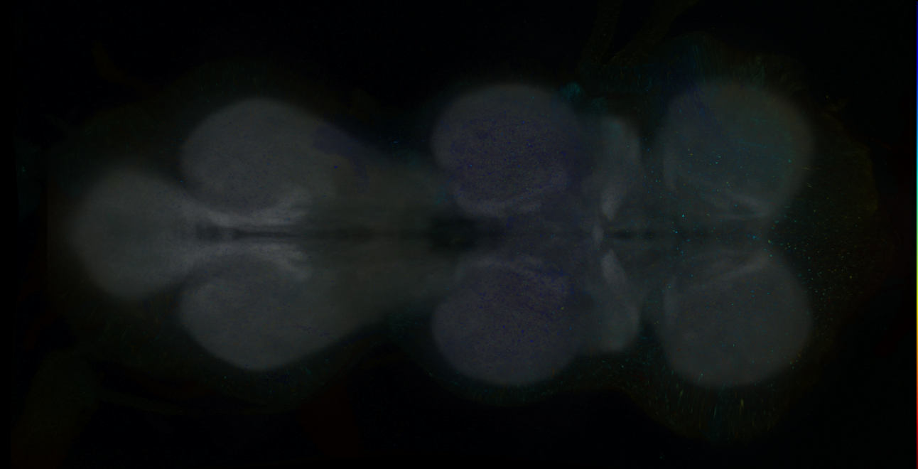 P{GMR14G01-GAL4} expression pattern
