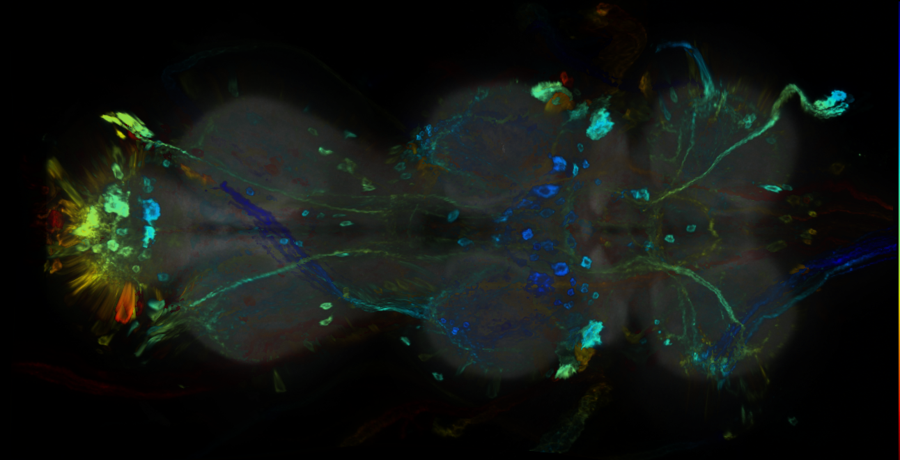 P{GMR14G02-GAL4} expression pattern