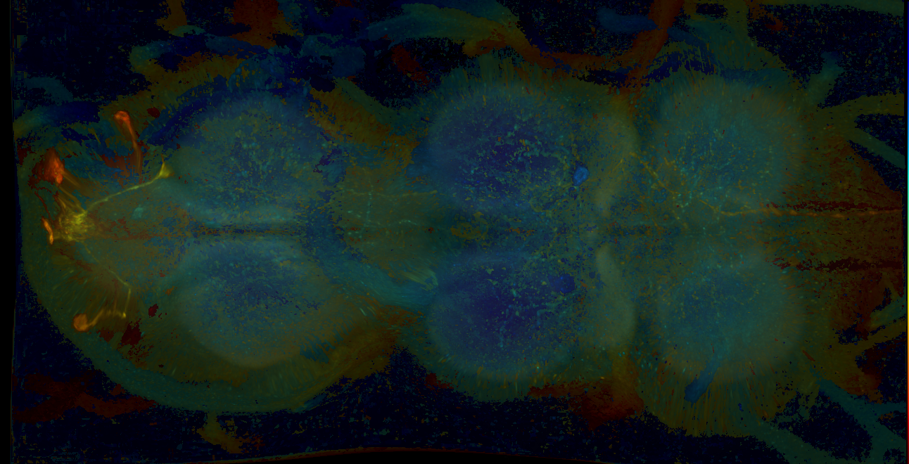 P{GMR14G07-GAL4} expression pattern