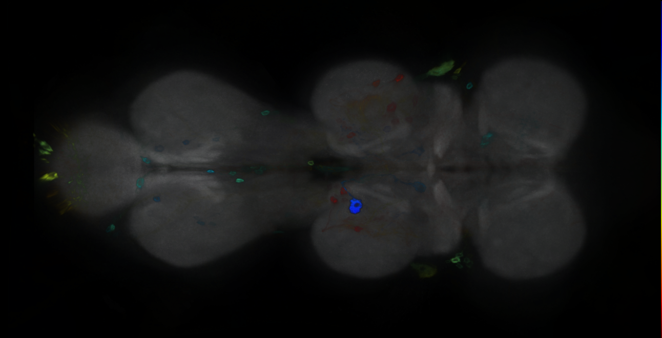 P{GMR14G08-GAL4} expression pattern